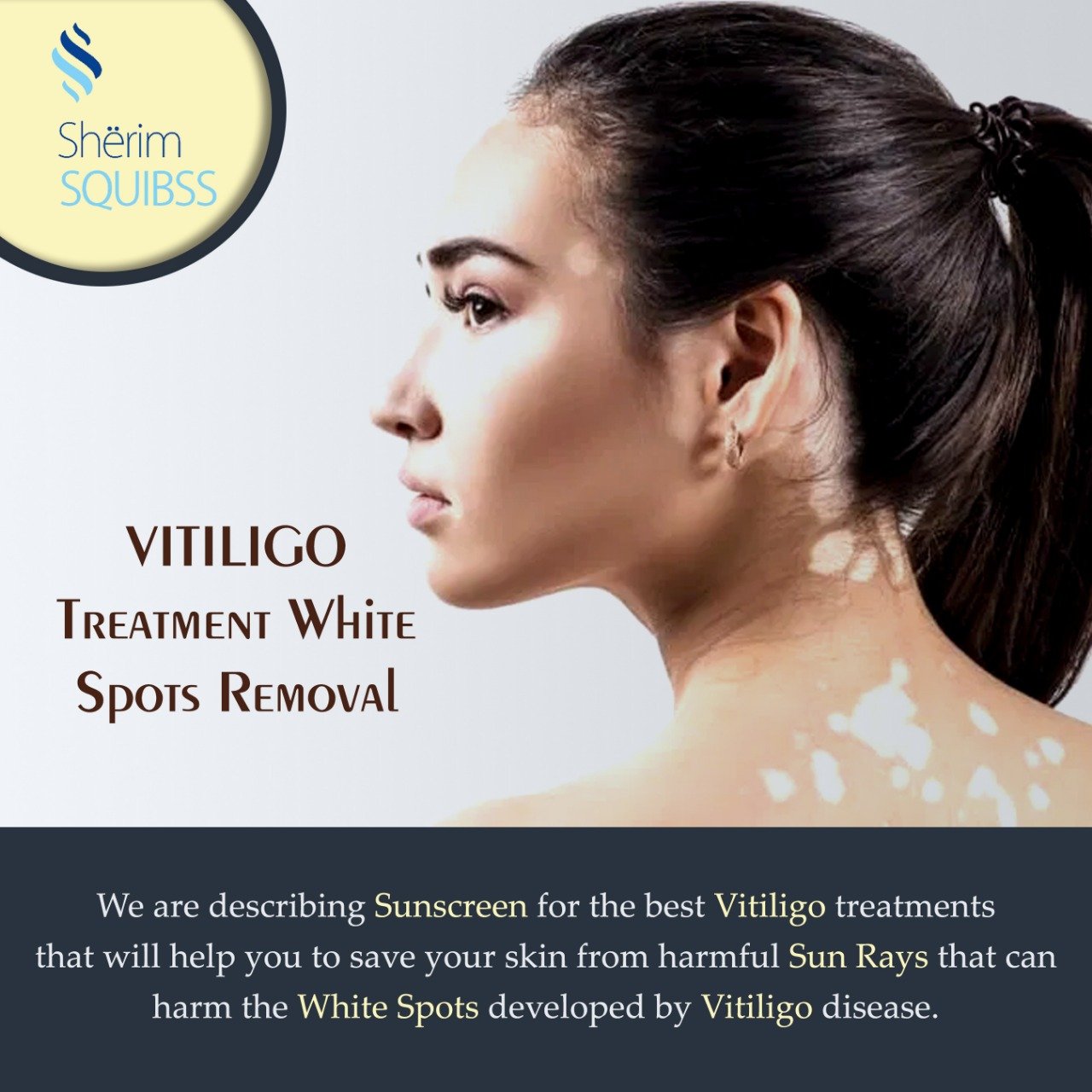 Vitiligo treatment white spots removal